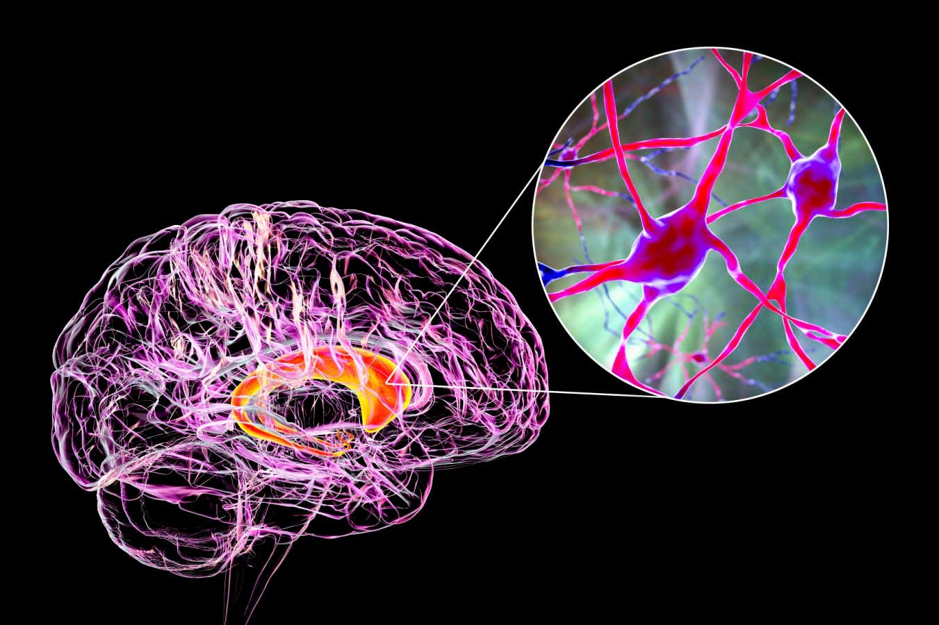 The caudate nuclei, parts of the brain affected by Huntington's disease