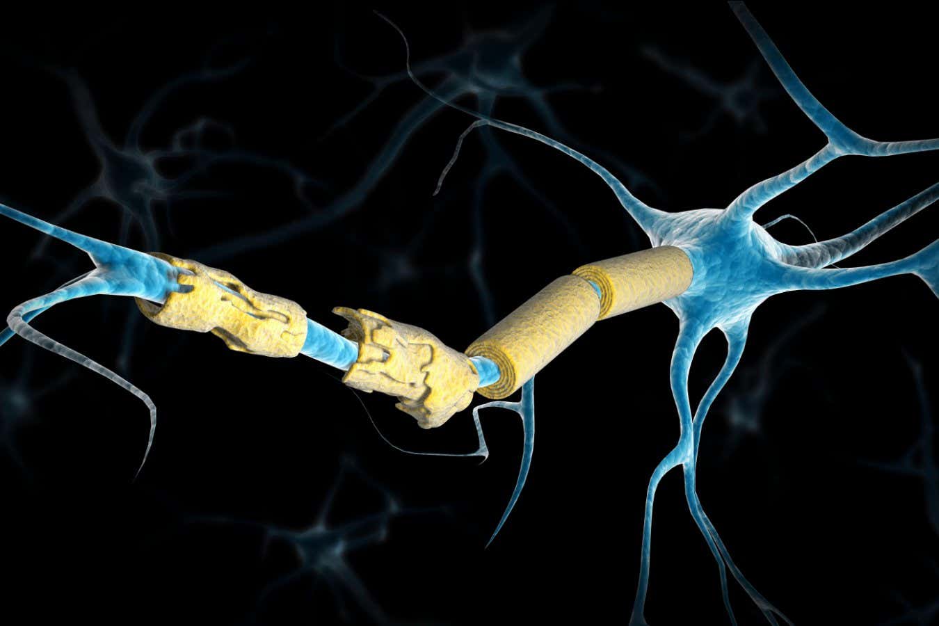 Conceptual image of a neuron damaged by multiple sclerosis