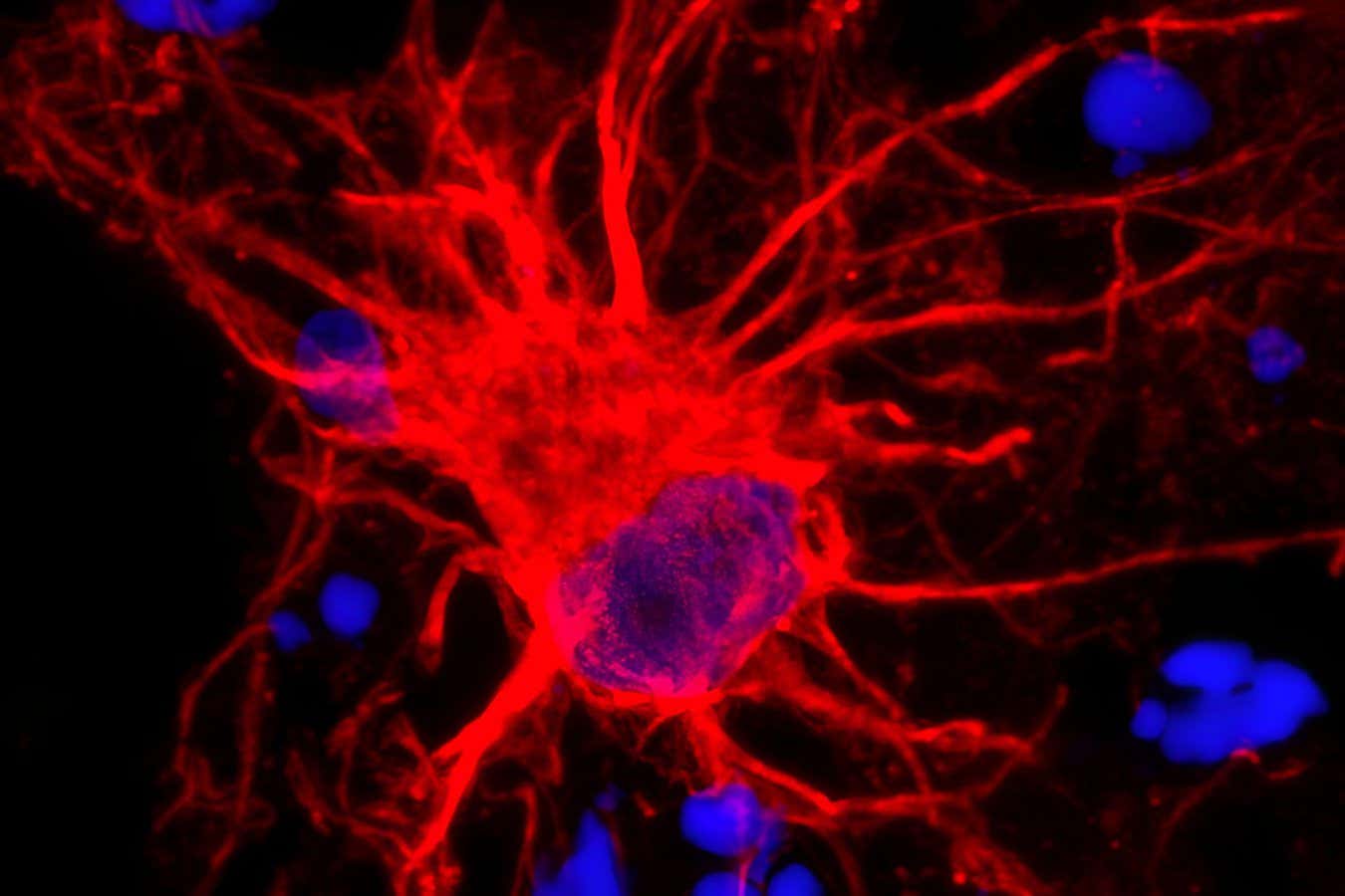 2JKFTNG Researchers study star-shaped brain cells: NIH-funded researchers have used 3D collections of brain tissue from human cells to study star-shaped astrocytes in the brain.
