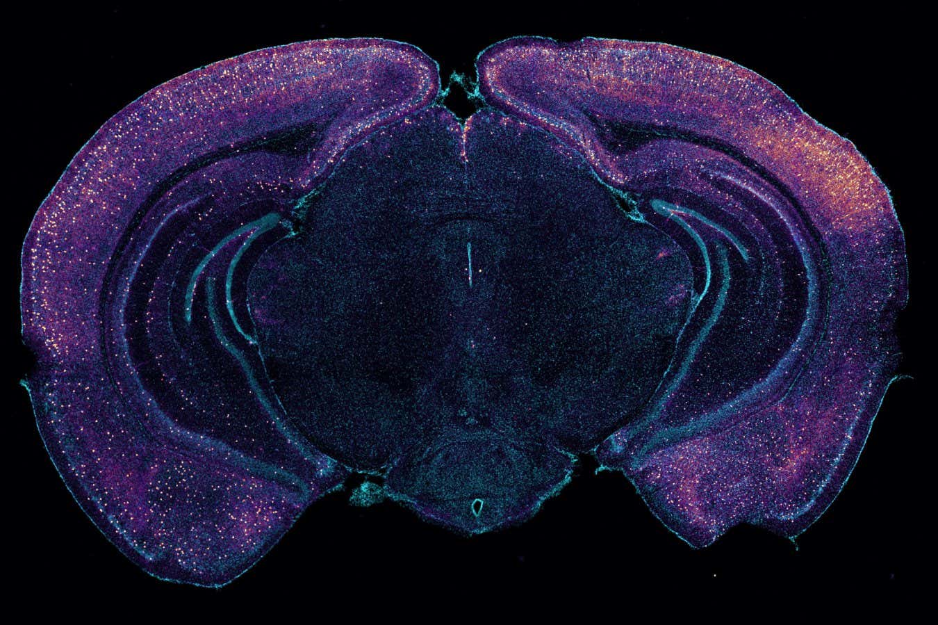 A cross-section of a mouse's brain highlighting neurons that seem to release a molecule that increases toxin clearance