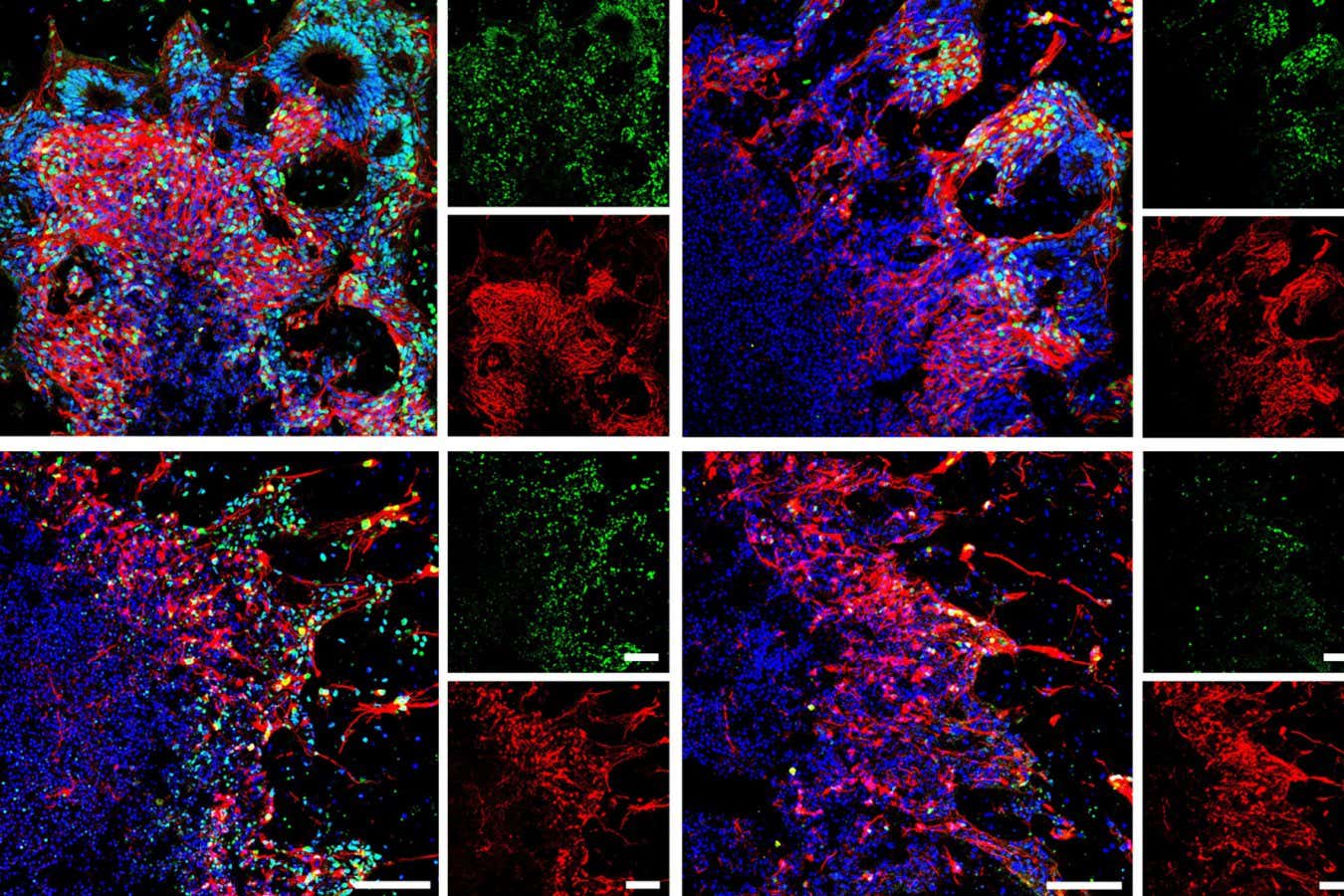 Thawed brain organoids shown via the imaging technique immunofluorescence staining