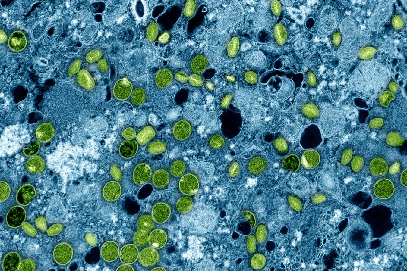 Transmission electron micrograph of mpox virus particles (green) found within cells (blue)