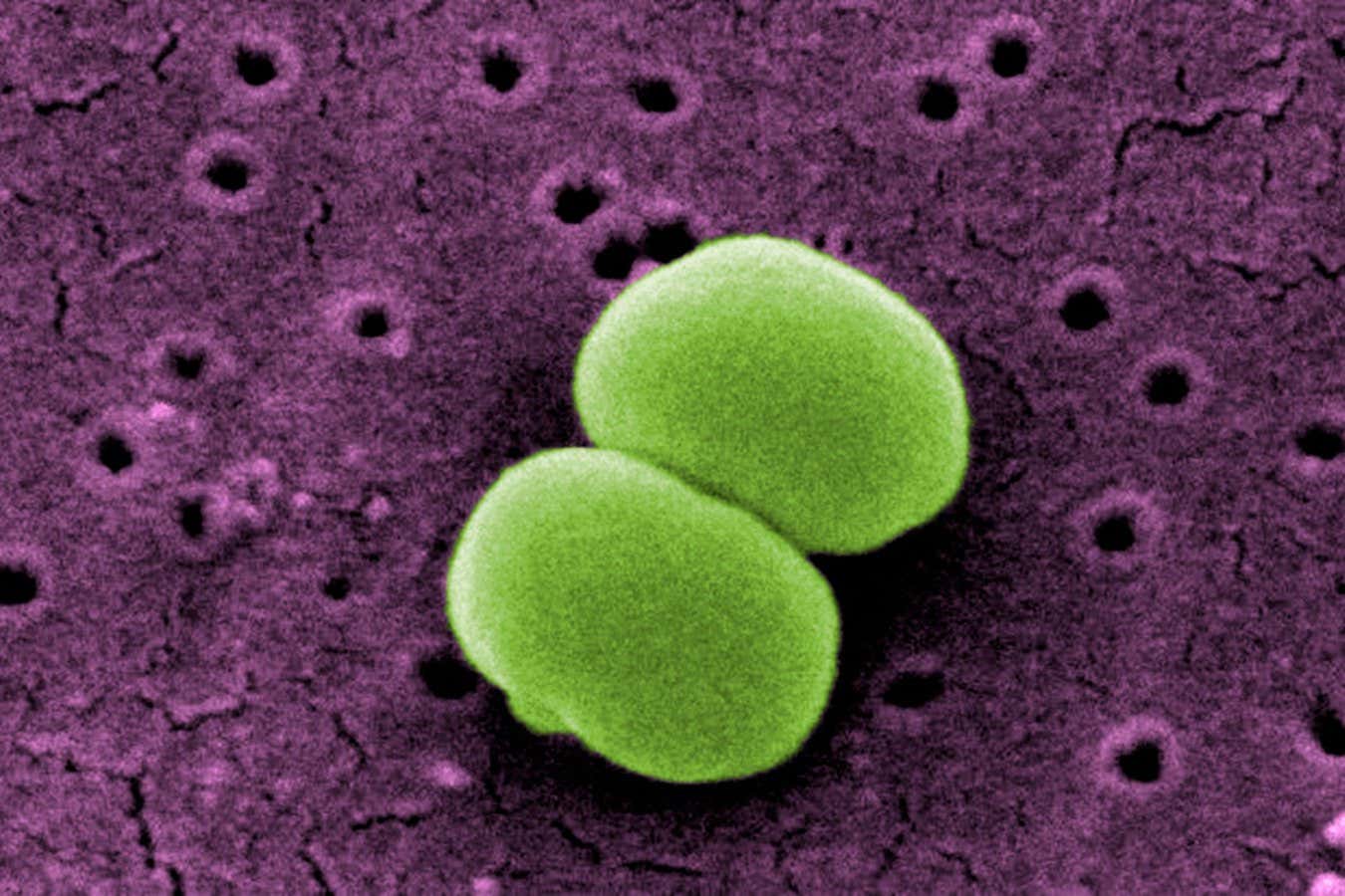 Scanning electron micrograph of Staphylococcus epidermidis bacteria