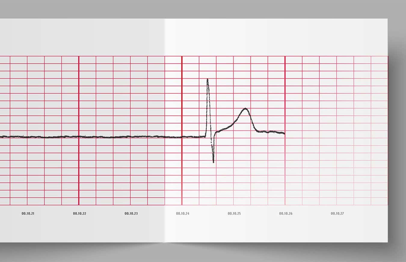 The radical treatments bringing people back from the brink of death