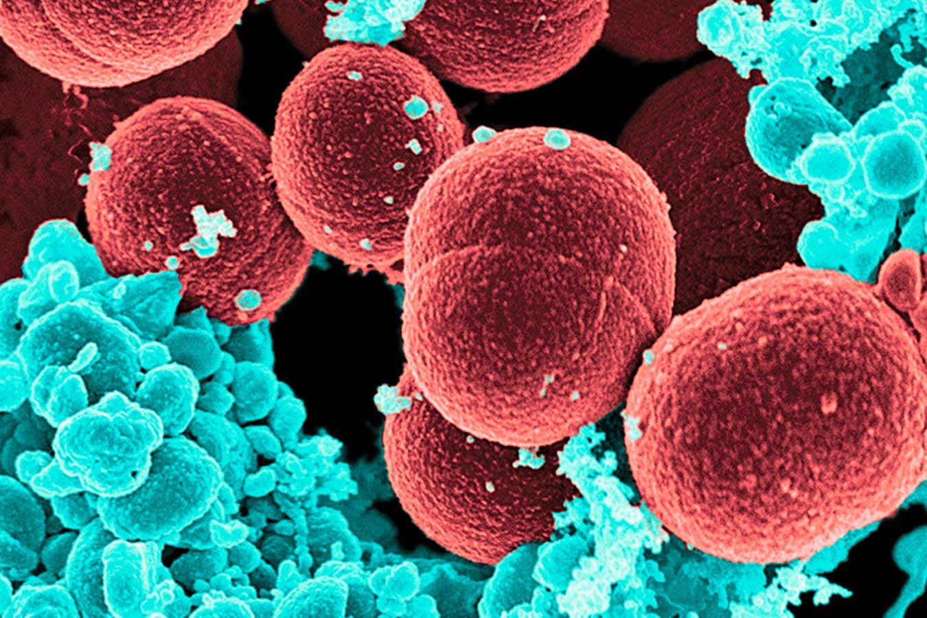 Coloured scanning electron micrograph (SEM) of methicillin-resistant Staphylococcus aureus (MRSA) bacteria.